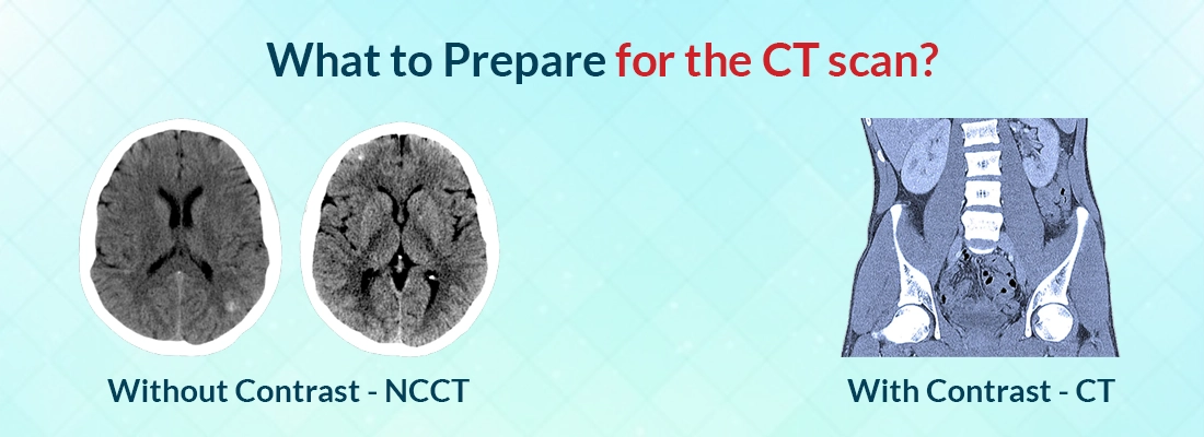 What to Prepare for the CT scan